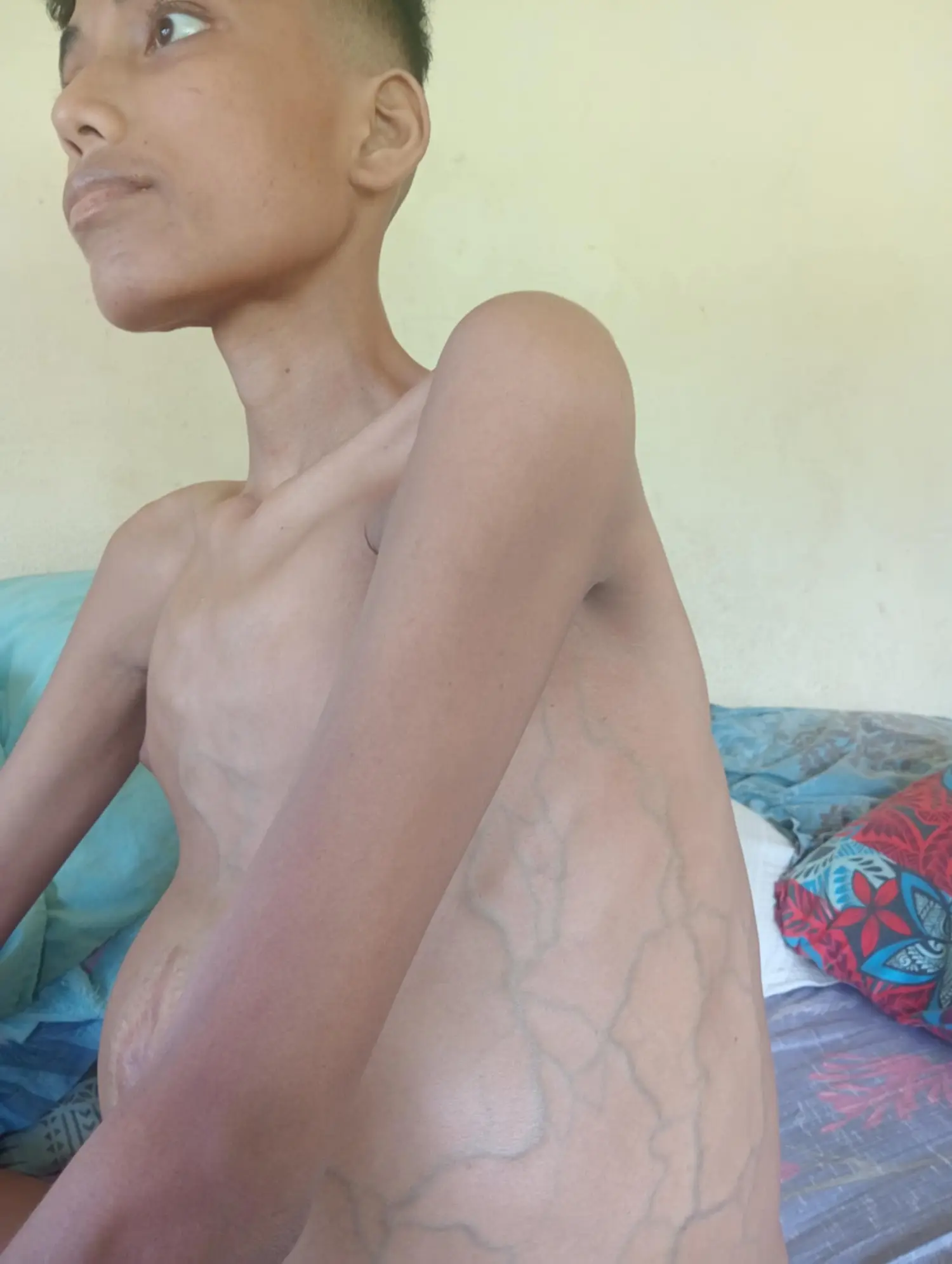  “I have hope": Mother’s plea to save teenage son