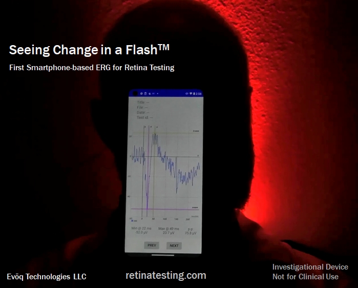  Evoq Technologies LLC Announces Launch of First Smartphone-Based Product for Retinal Health Testing