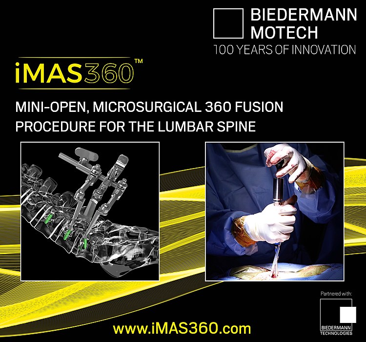 Biedermann Motech Announces Publication of Initial Clinical Outcome Data on Mini-Open, Microsurgical iMAS360™ Procedural Solution for the Lumbar Spine