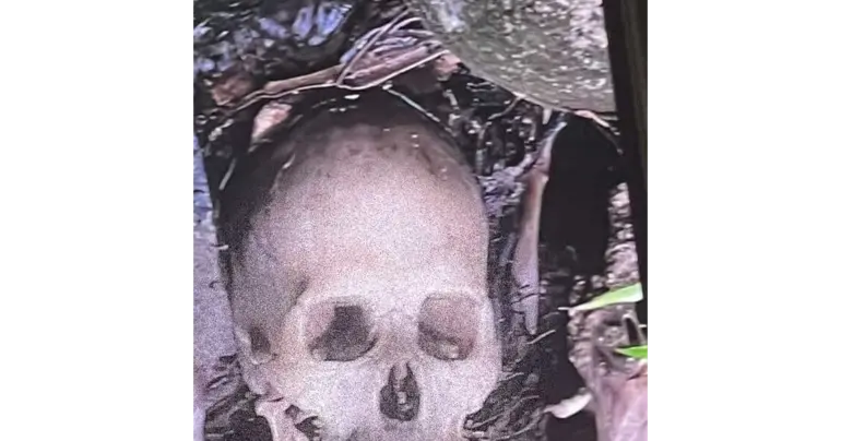 Fijian pathologist to conduct DNA test on Aleisa skeleton 