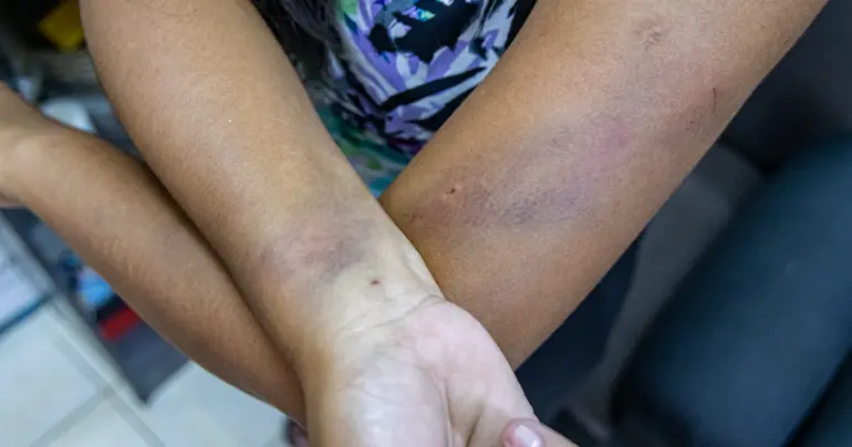 Are we allowing violence in our homes to become a norm?