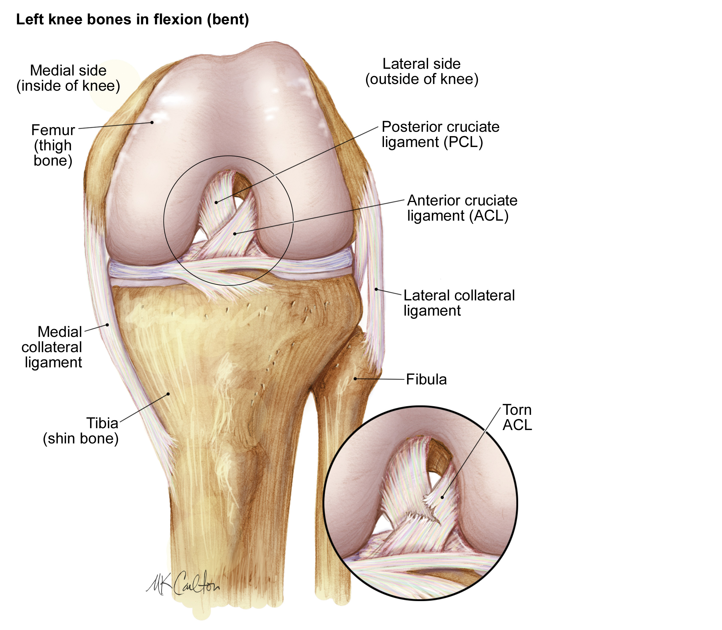 ACL Injuries and anatomy of the knee