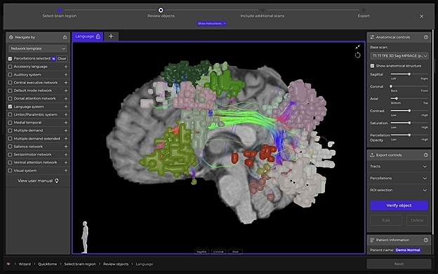 Omniscient Neurotechnology Launches Quicktome™ Brain Mapping Platform for Neurosurgery After Regulatory Clearance in United States, Canada and Australia